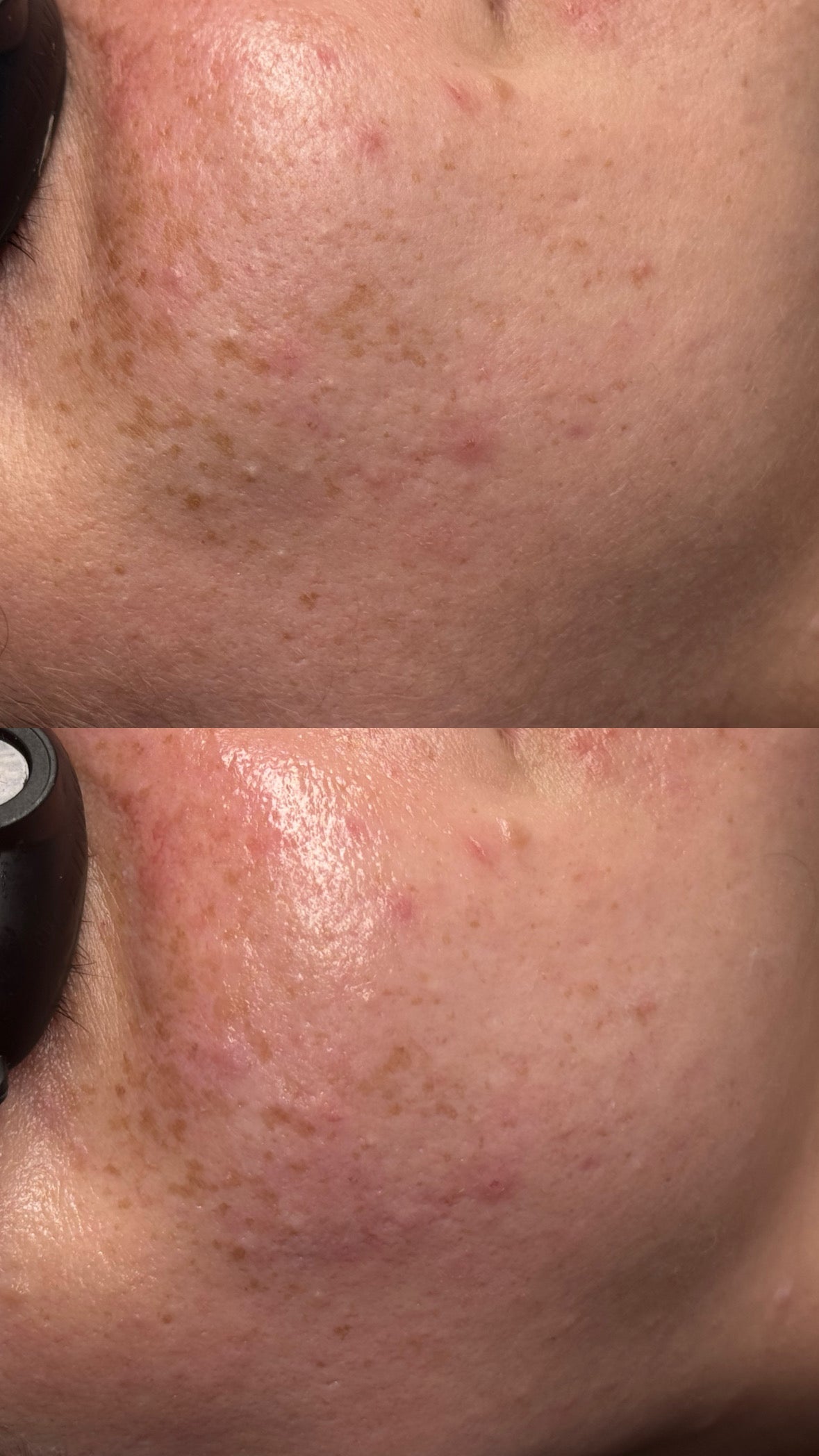 Customized Facial (60 Min)
