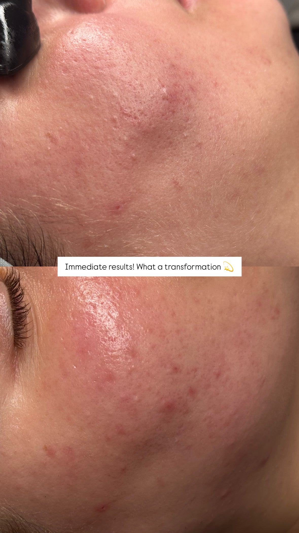 Customized Facial (90 Min)
