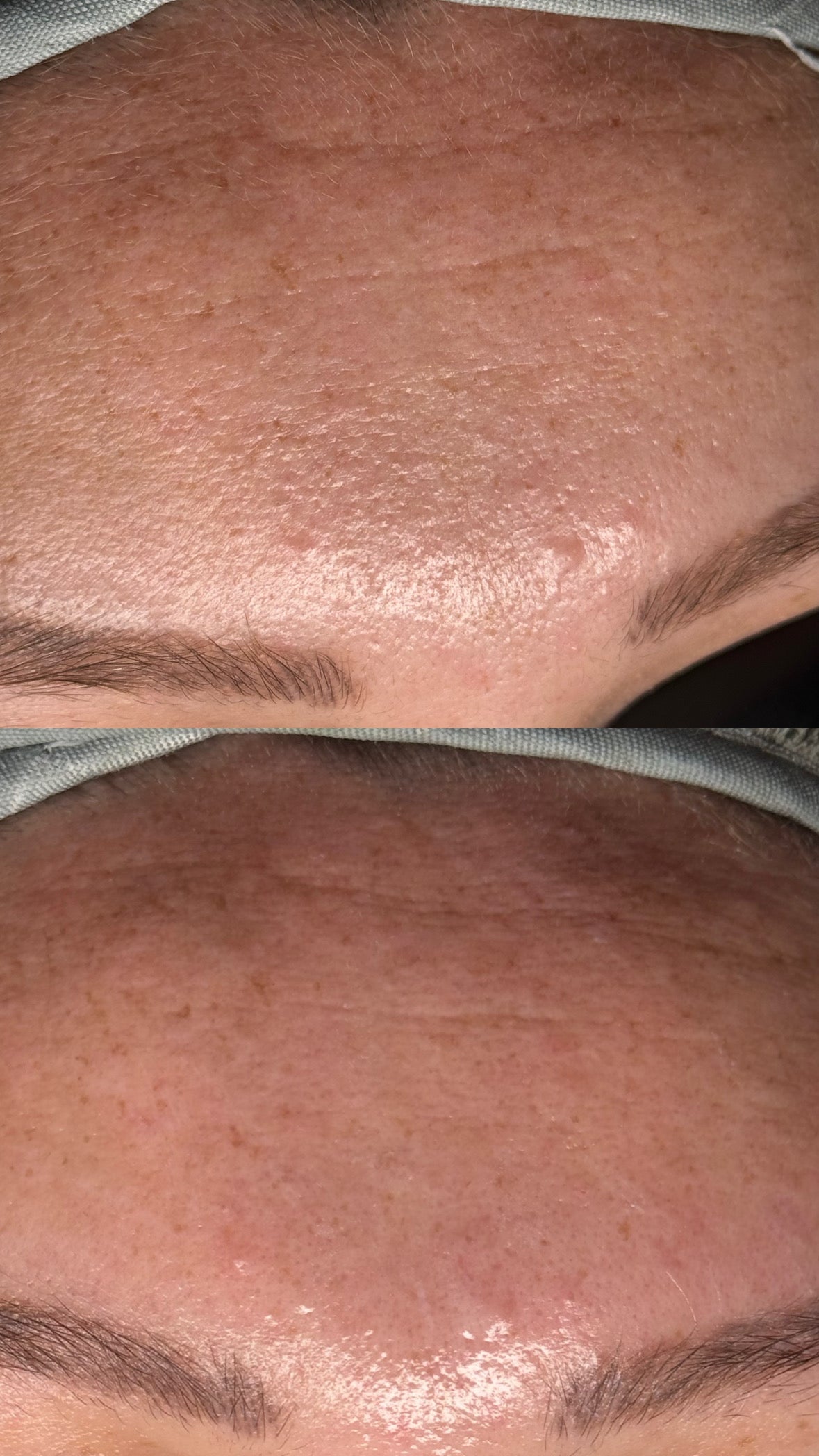 Customized Facial (60 Min)