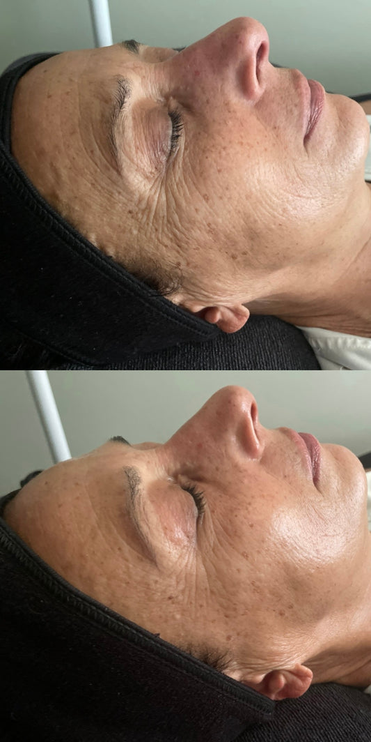 90 Minute Facial