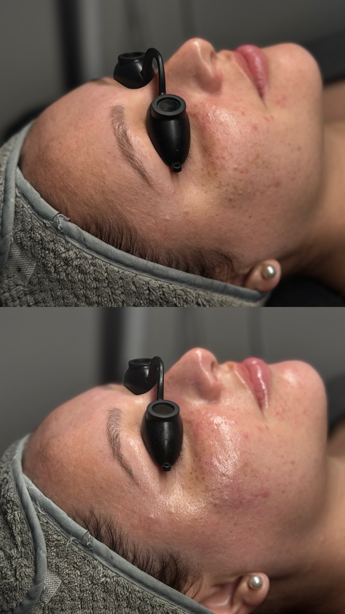 Customized Facial (60 Min)