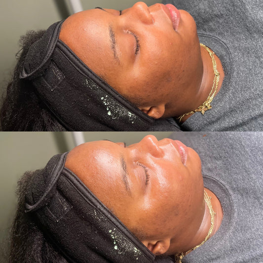 60 Minute Facial Massage