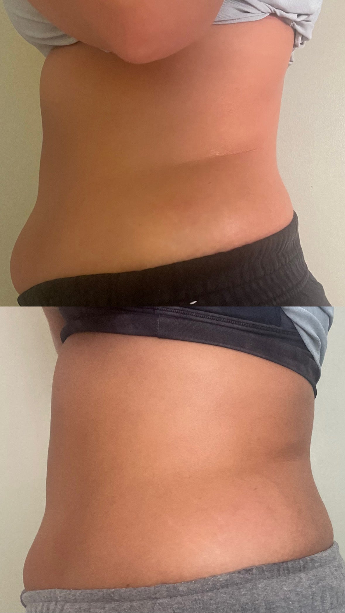 *REQUIRED* Body Sculpting Consultation